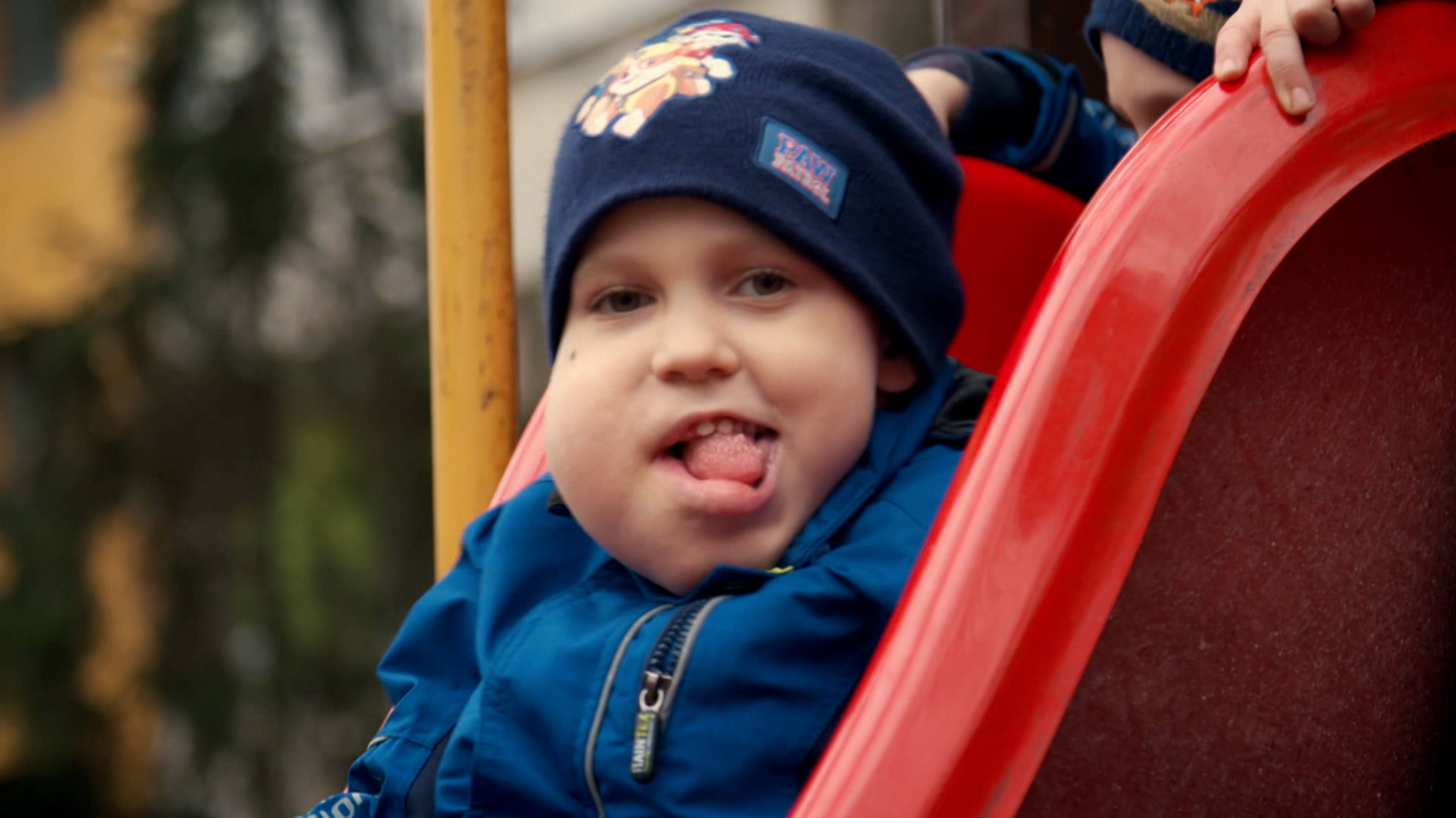 My Son Has Three Arms