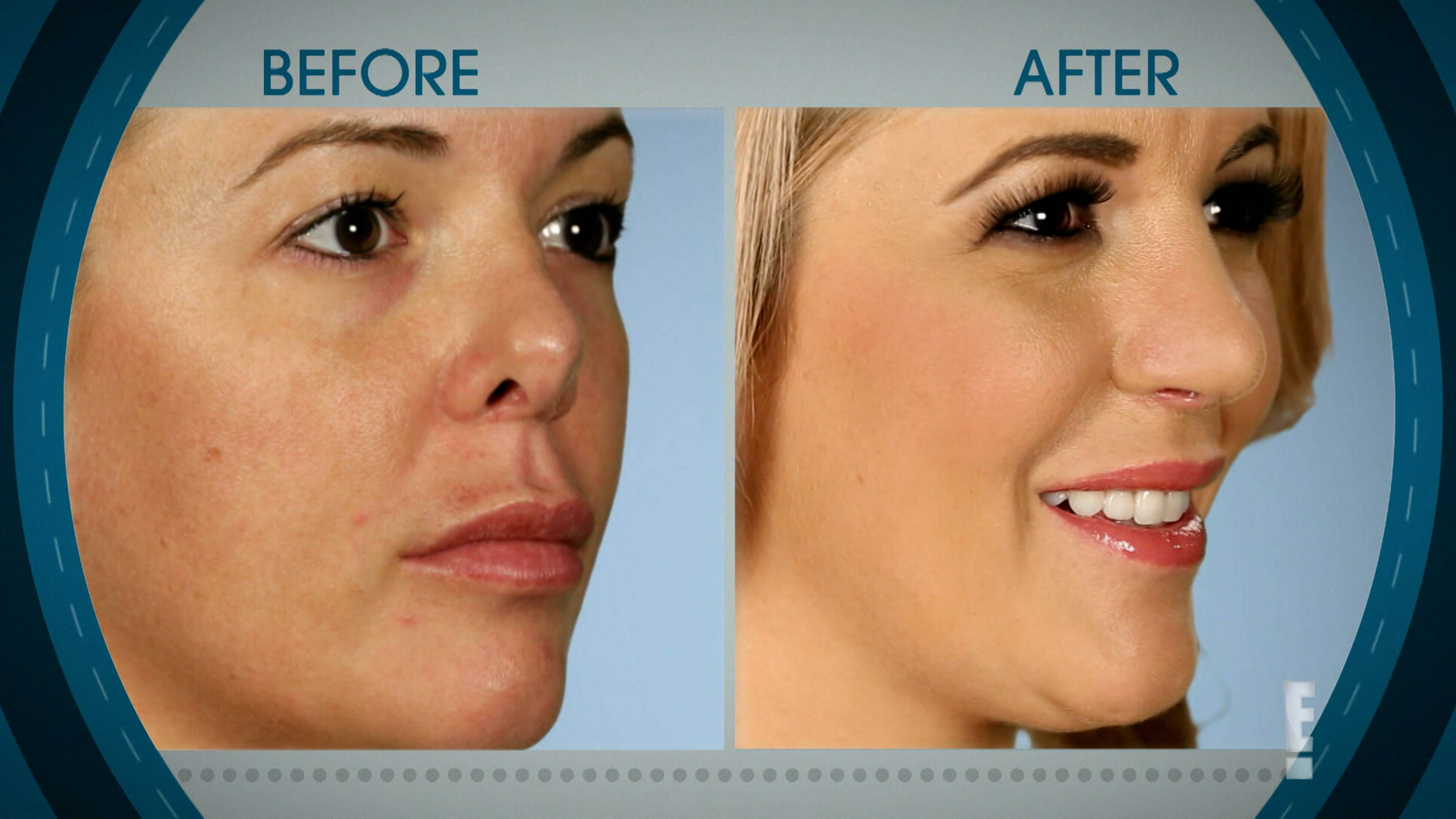 بوتشيد: تافيسد كيسيز