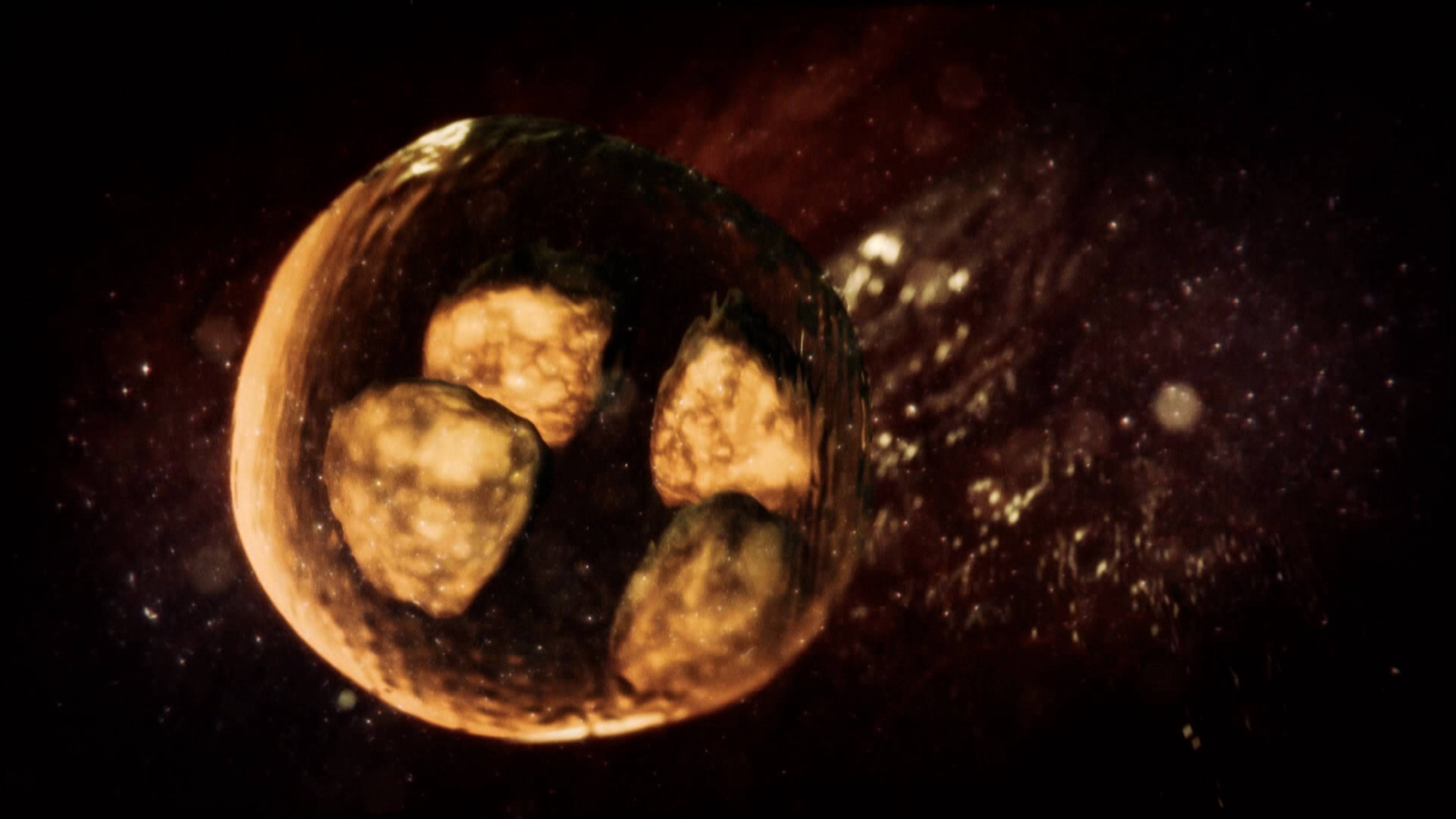 My Brain Is Under Attack