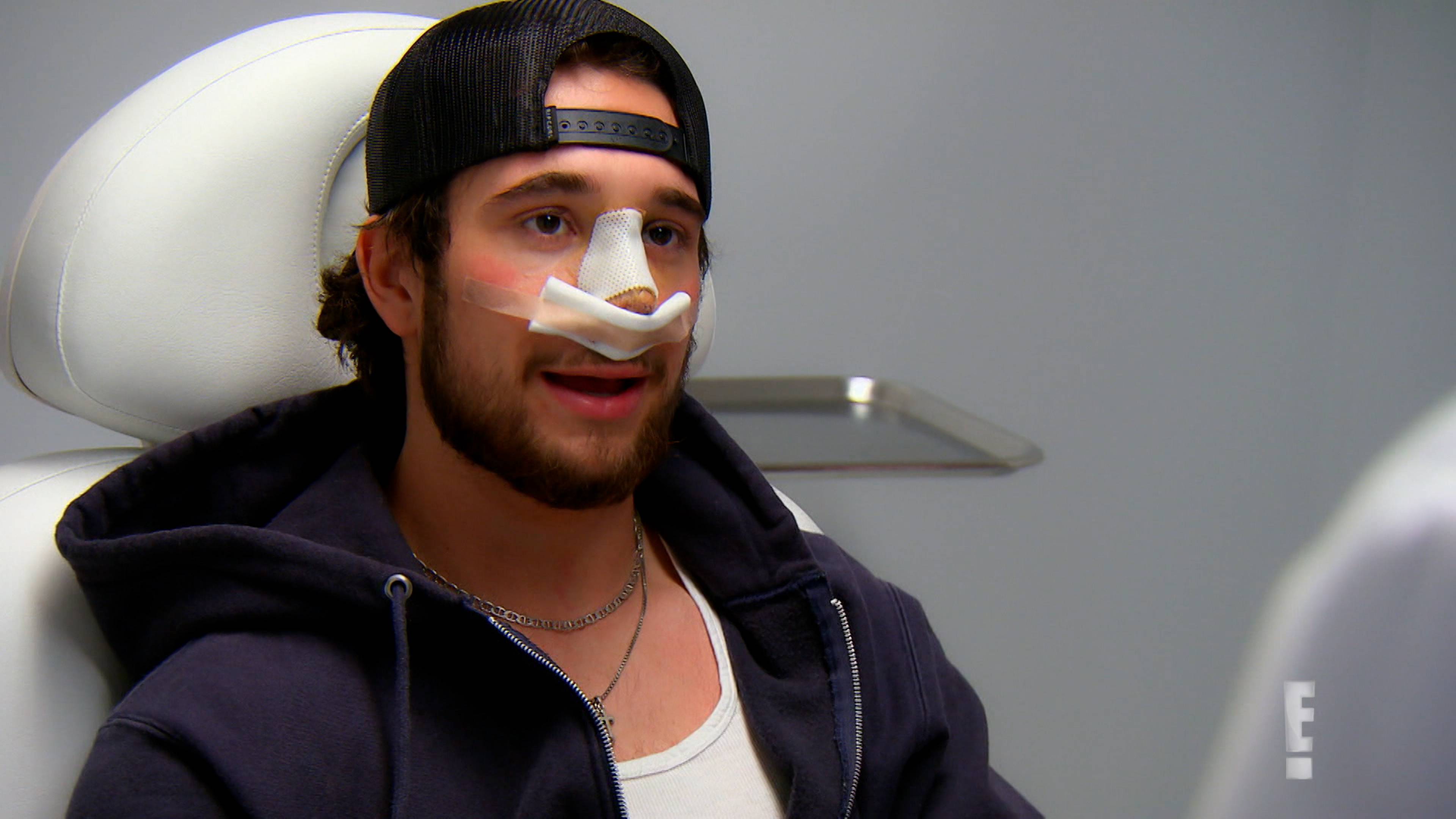 إي سكار إز بورن