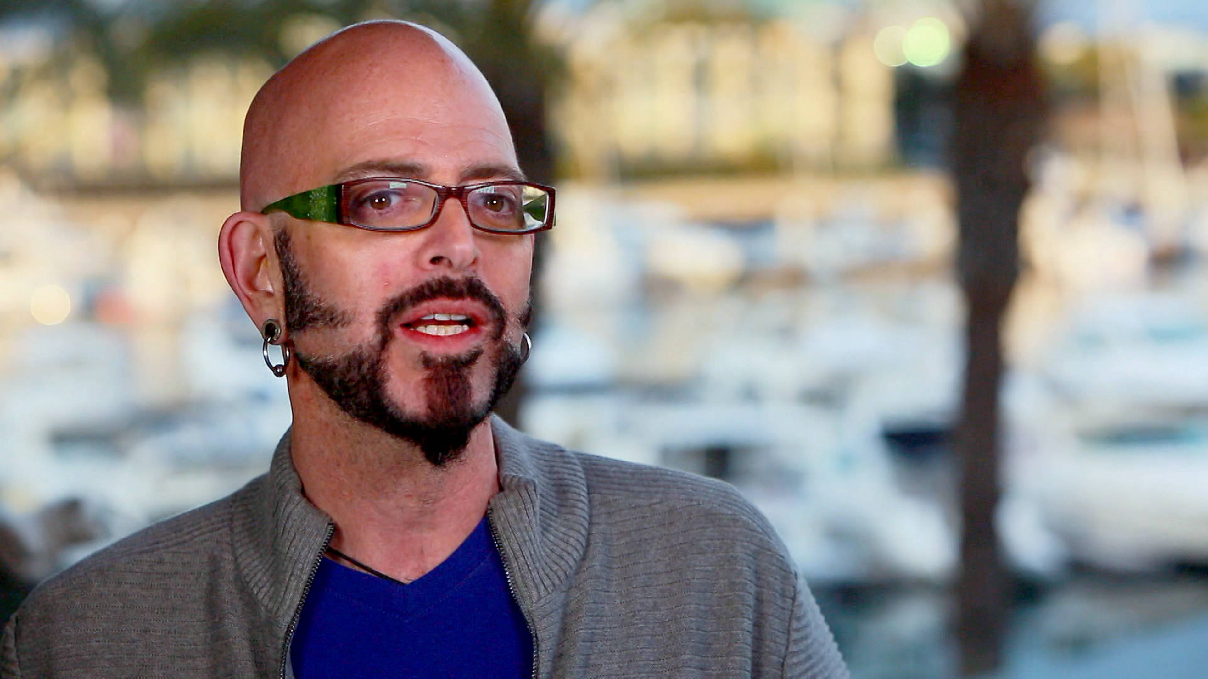 بداية الصلع