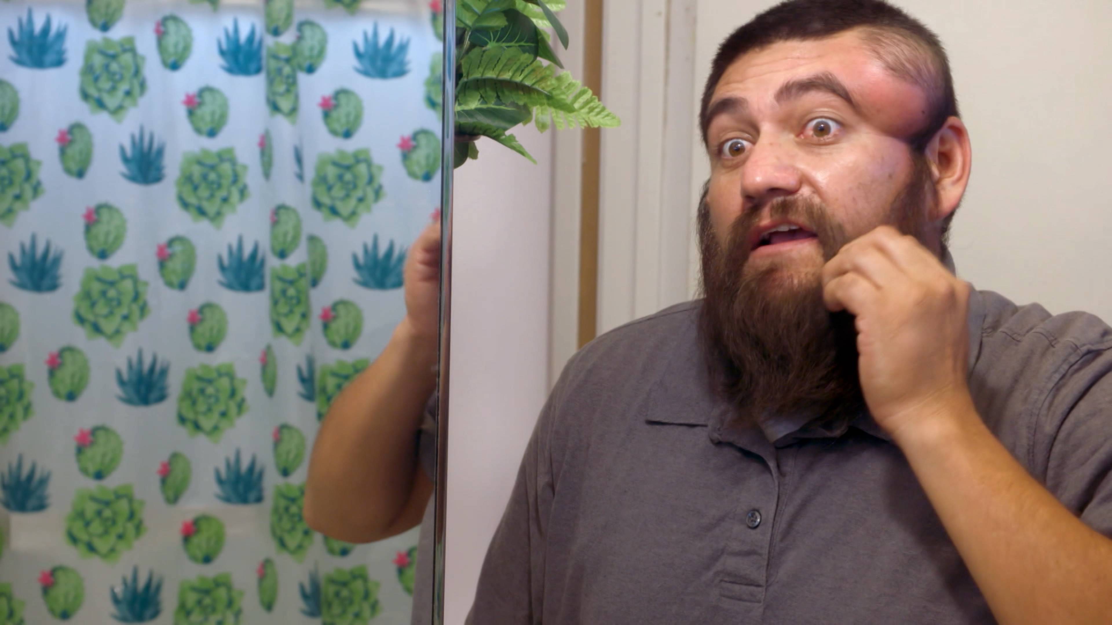 نتوءات مؤلمة