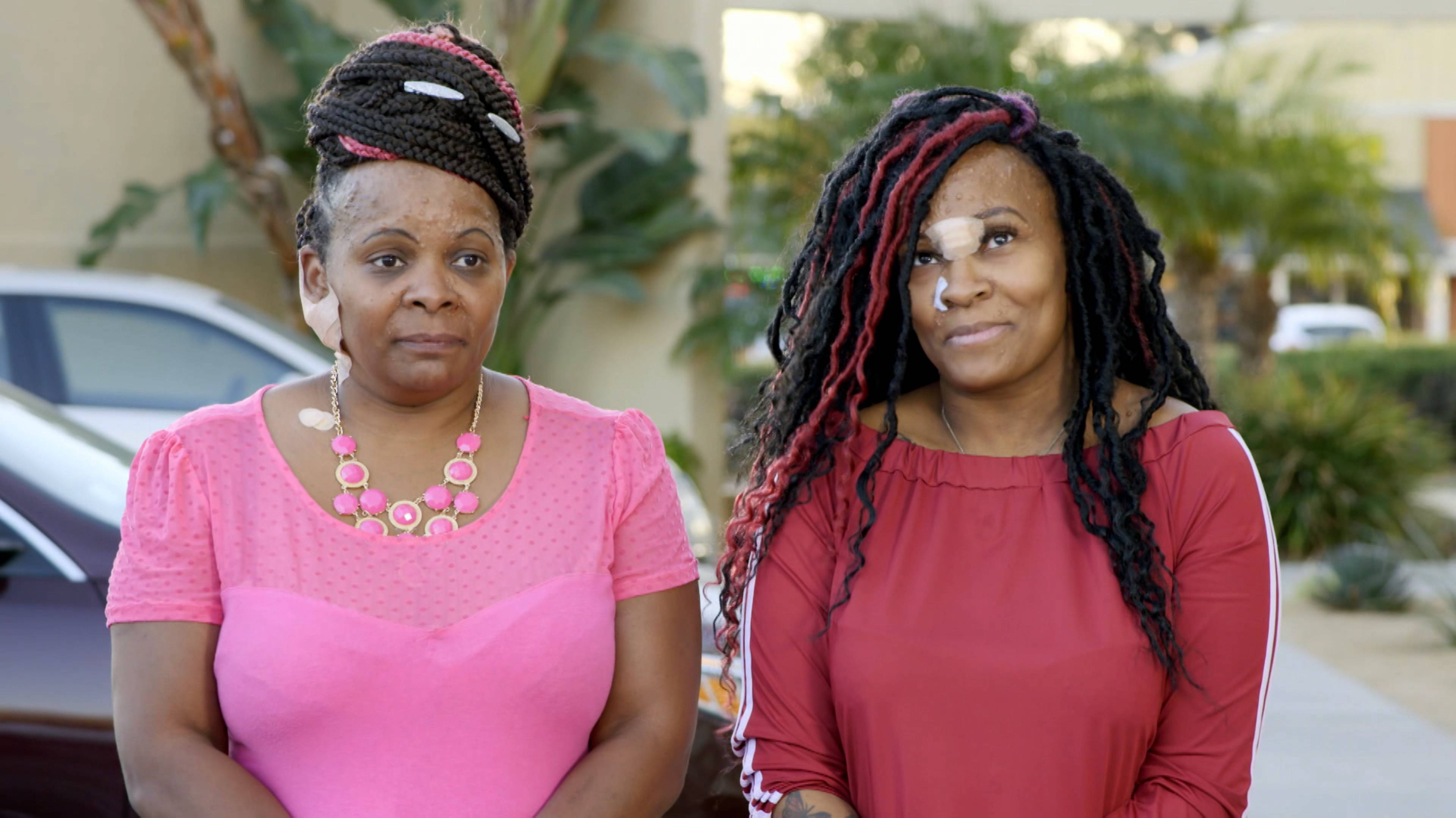 أنفي الضخم يقتلني