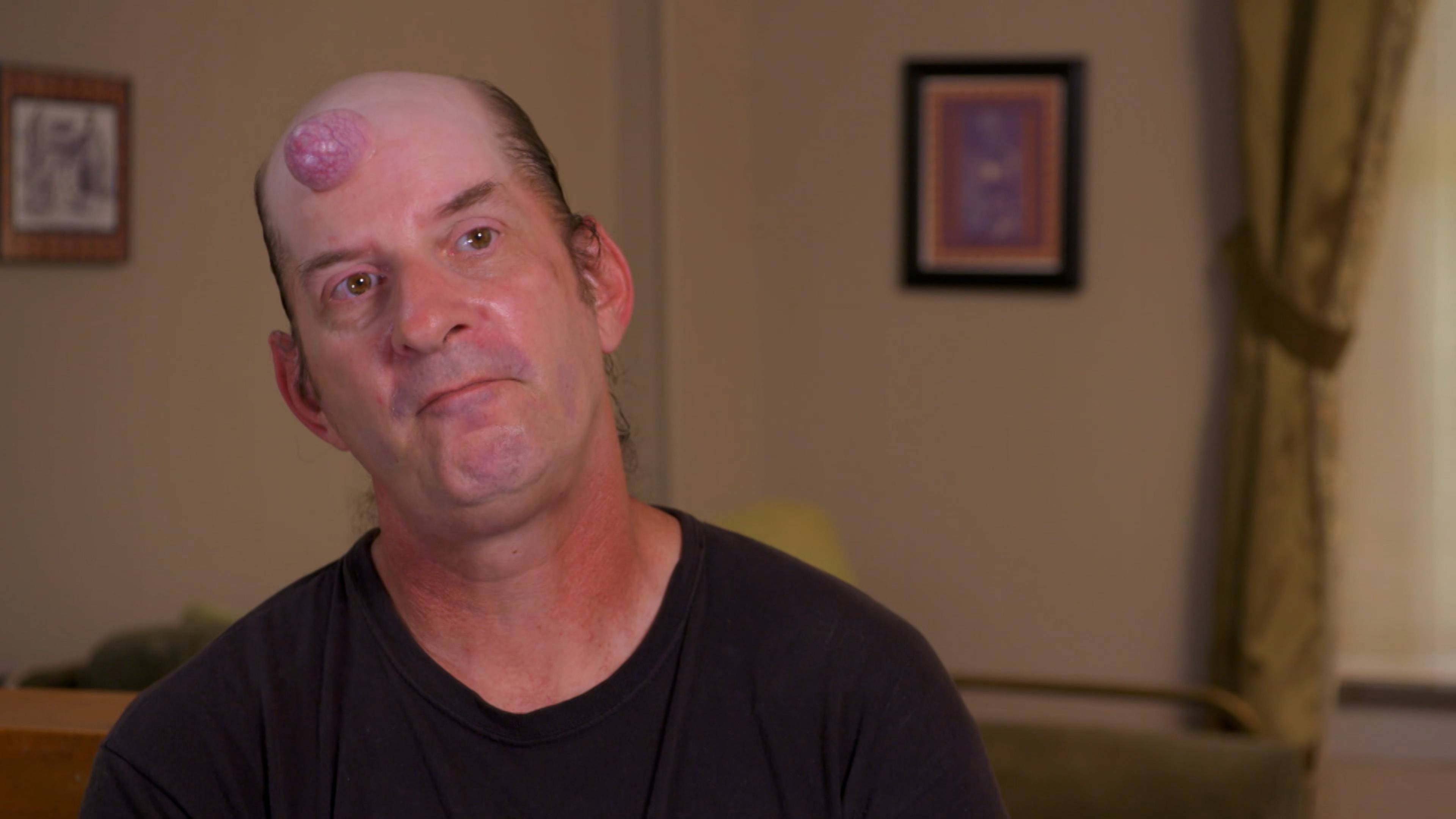 الندبات التي لا تنتهي