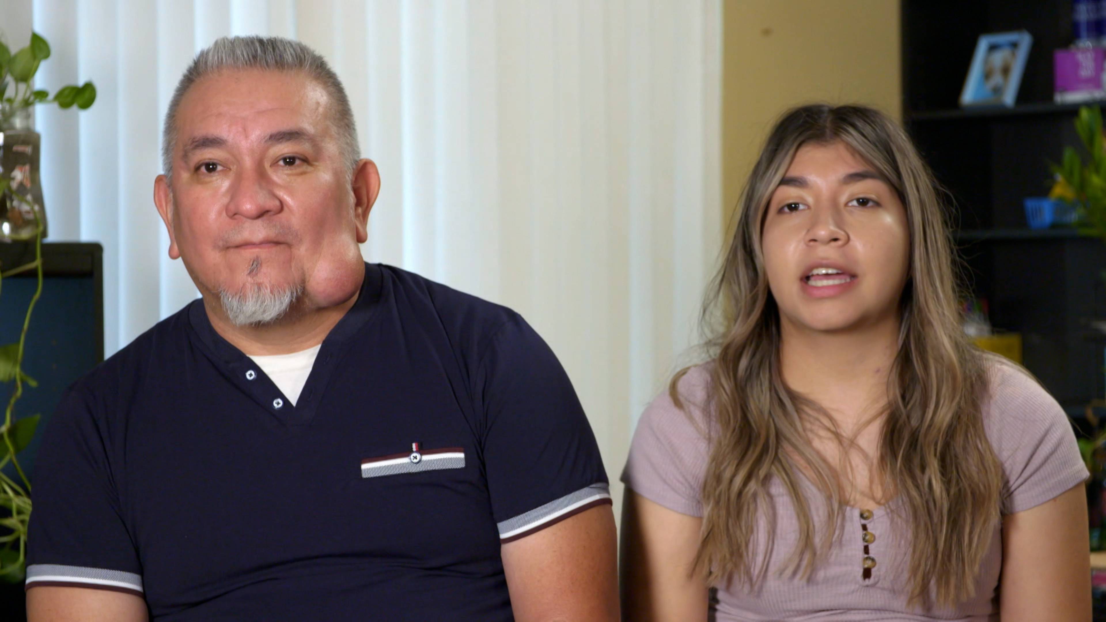 نتوء يشبه عقلي