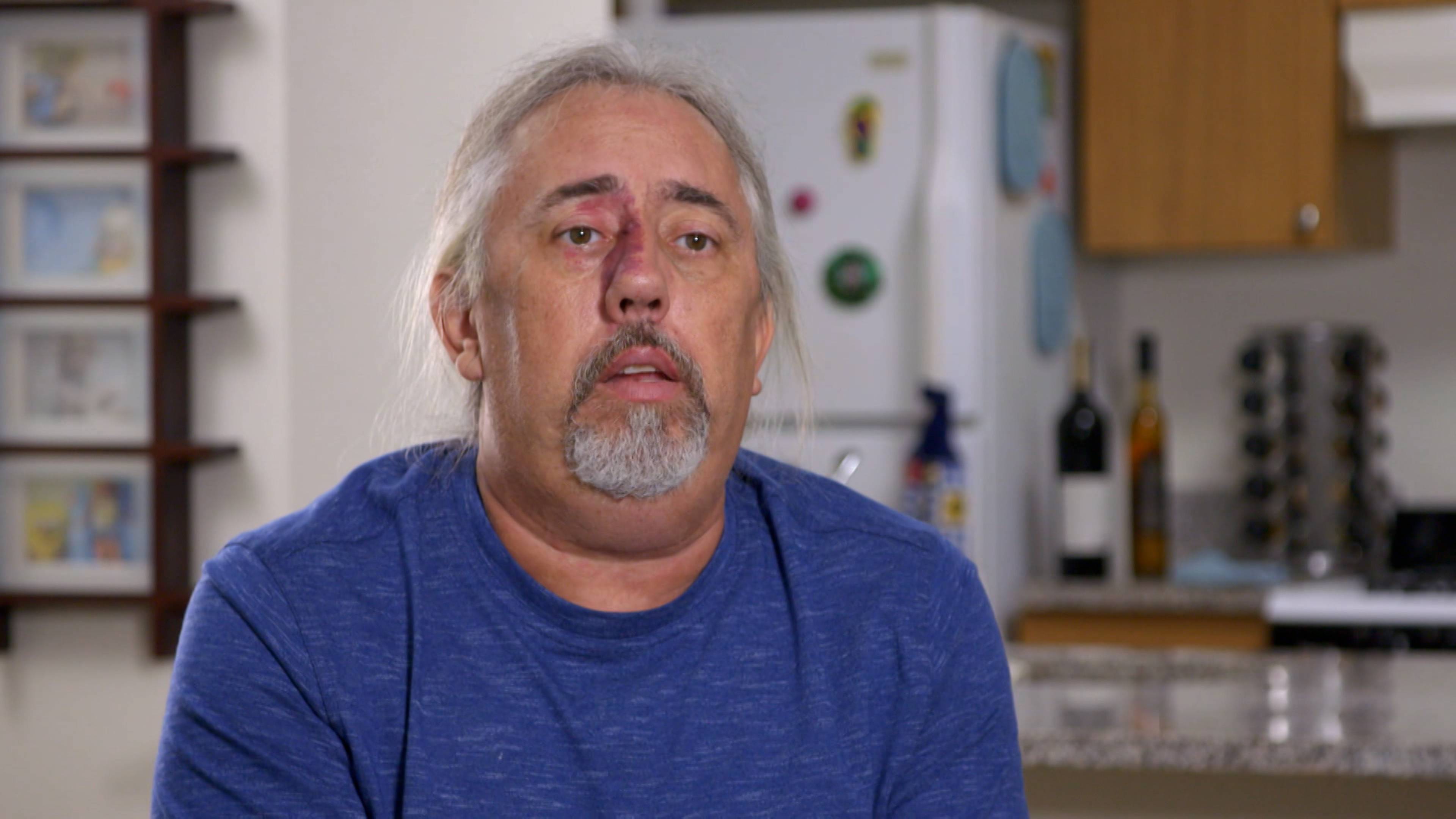 هل تصاب الإغوانا بالبثور أيضًا؟