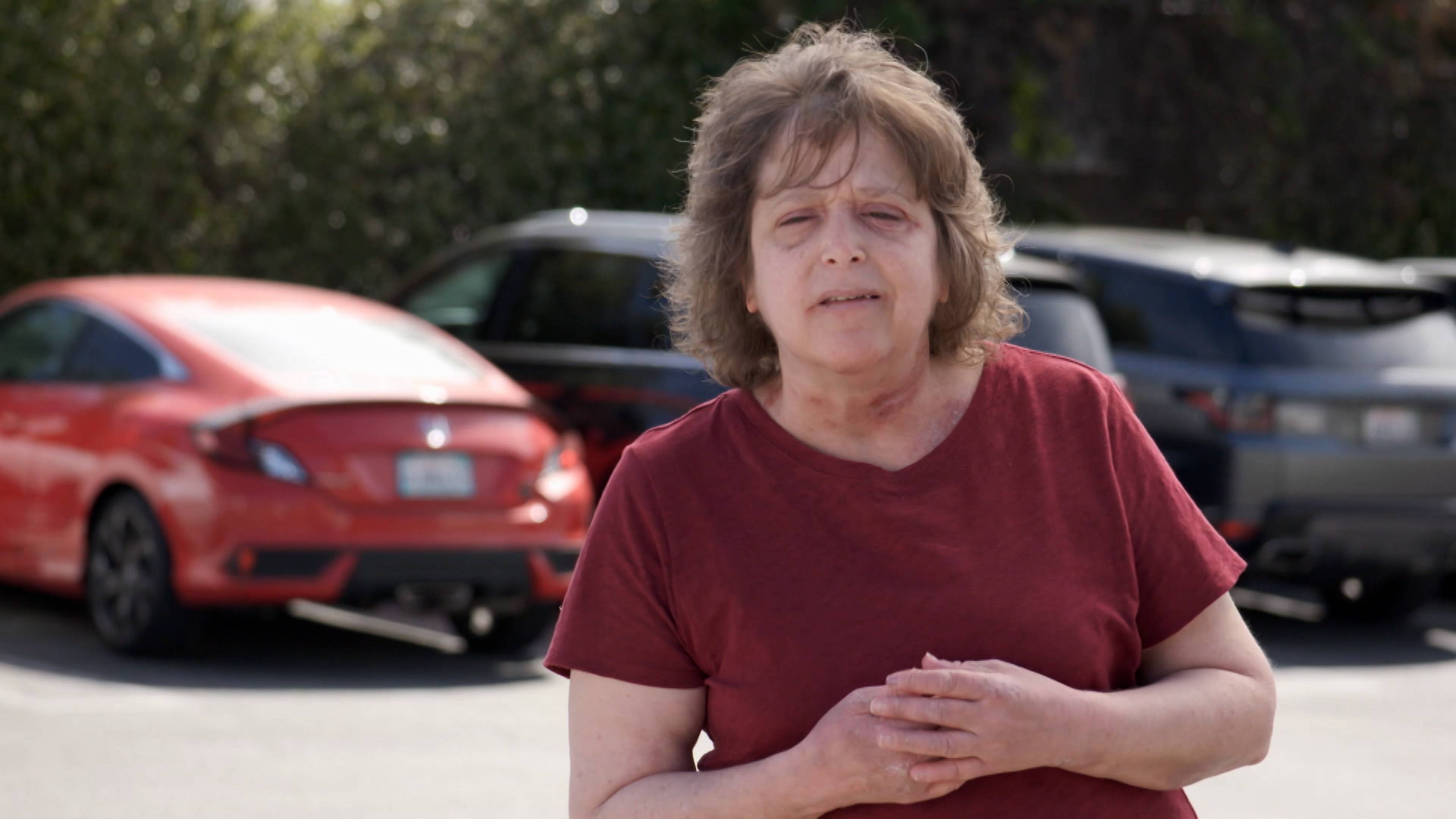 نتوءات رأس القرنبيط