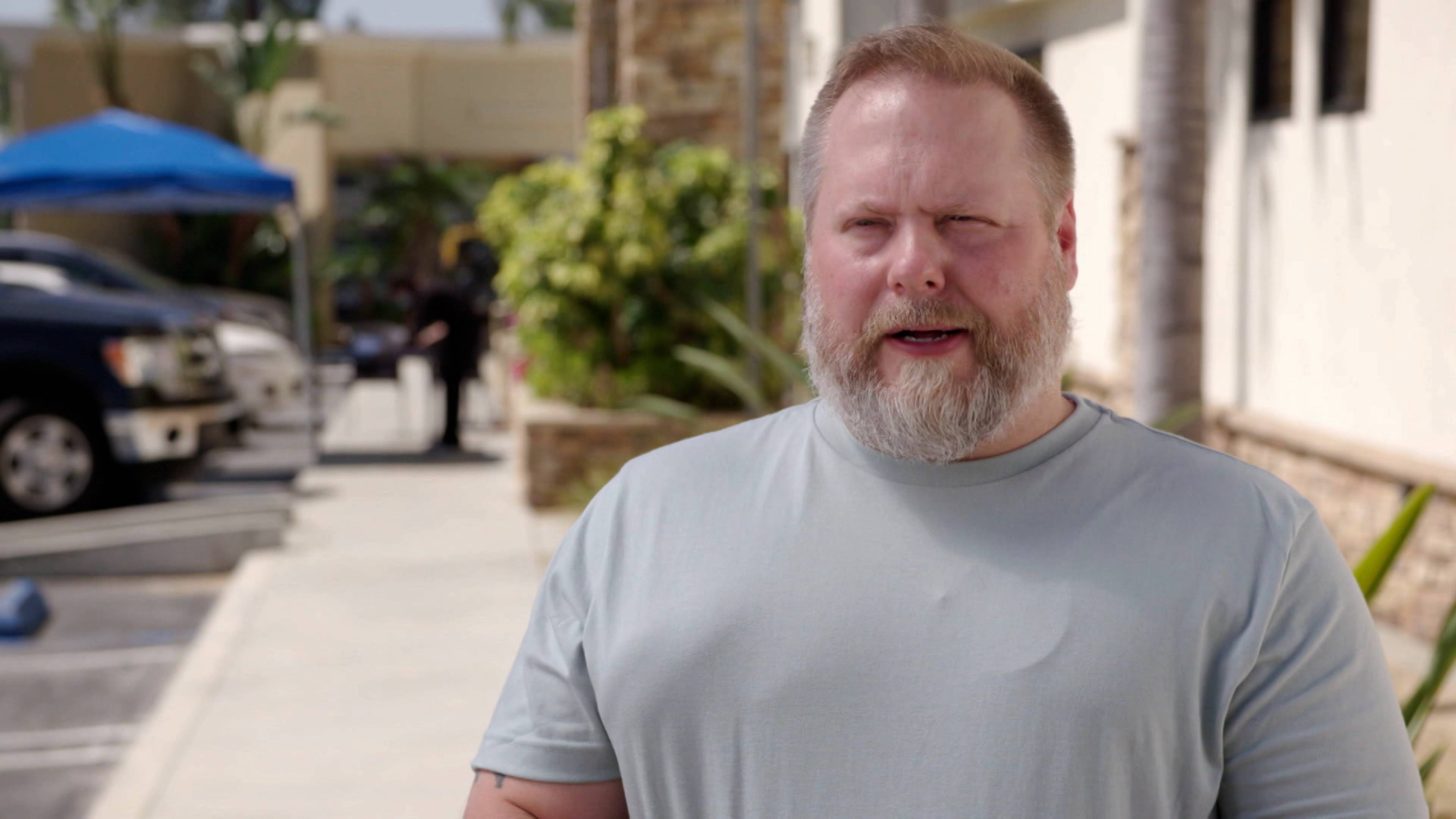 ملخص: تكيس مضاعف