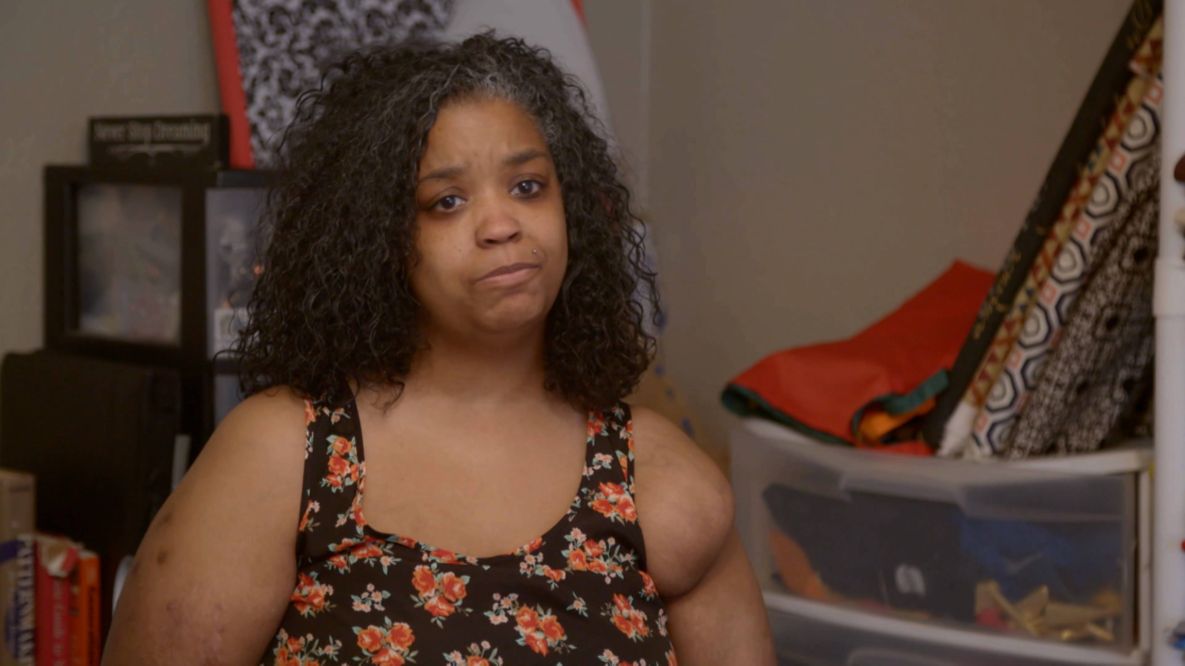 ملخص: عيب في الندوب