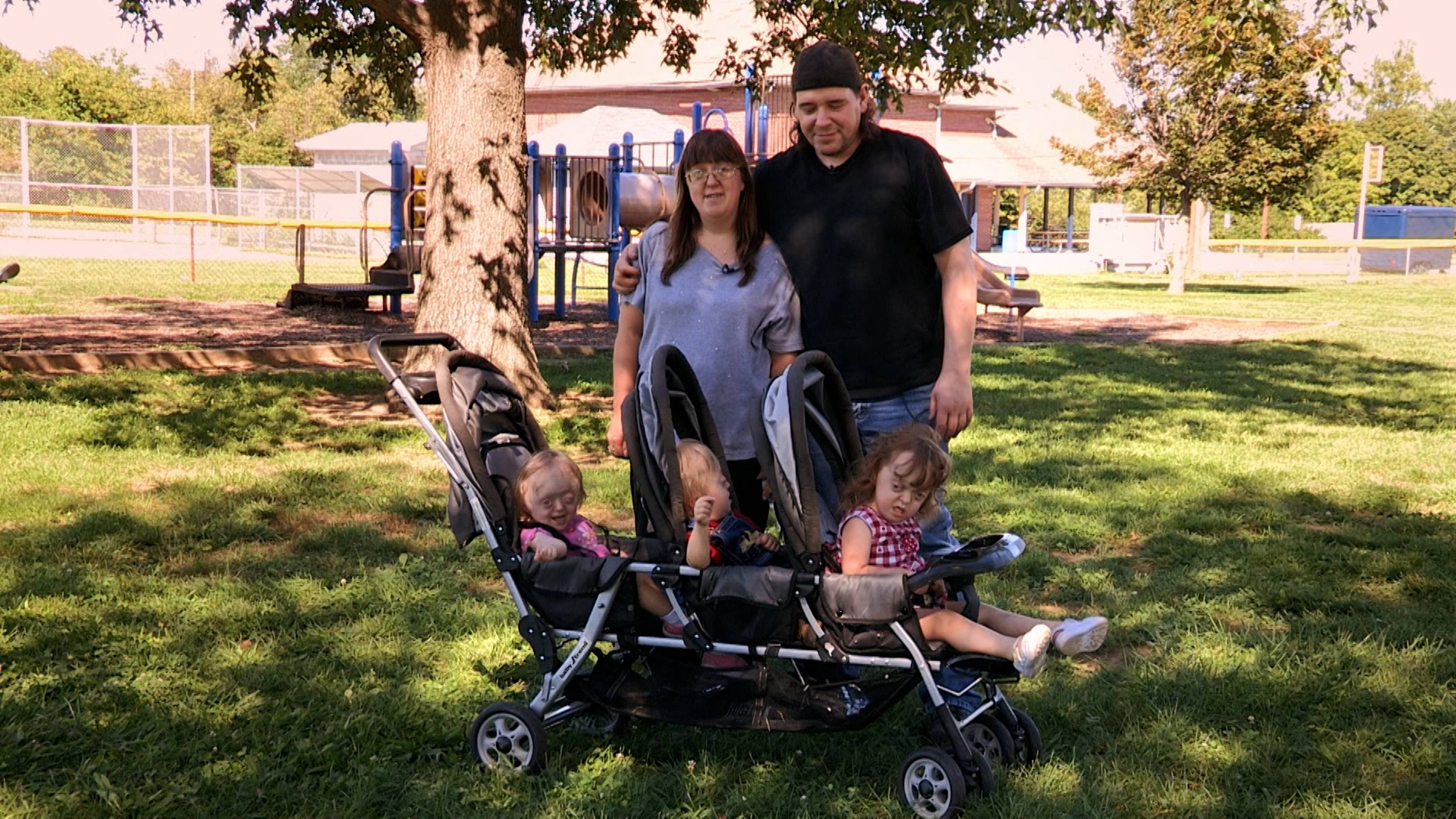 My Son Has Super-Sized Legs