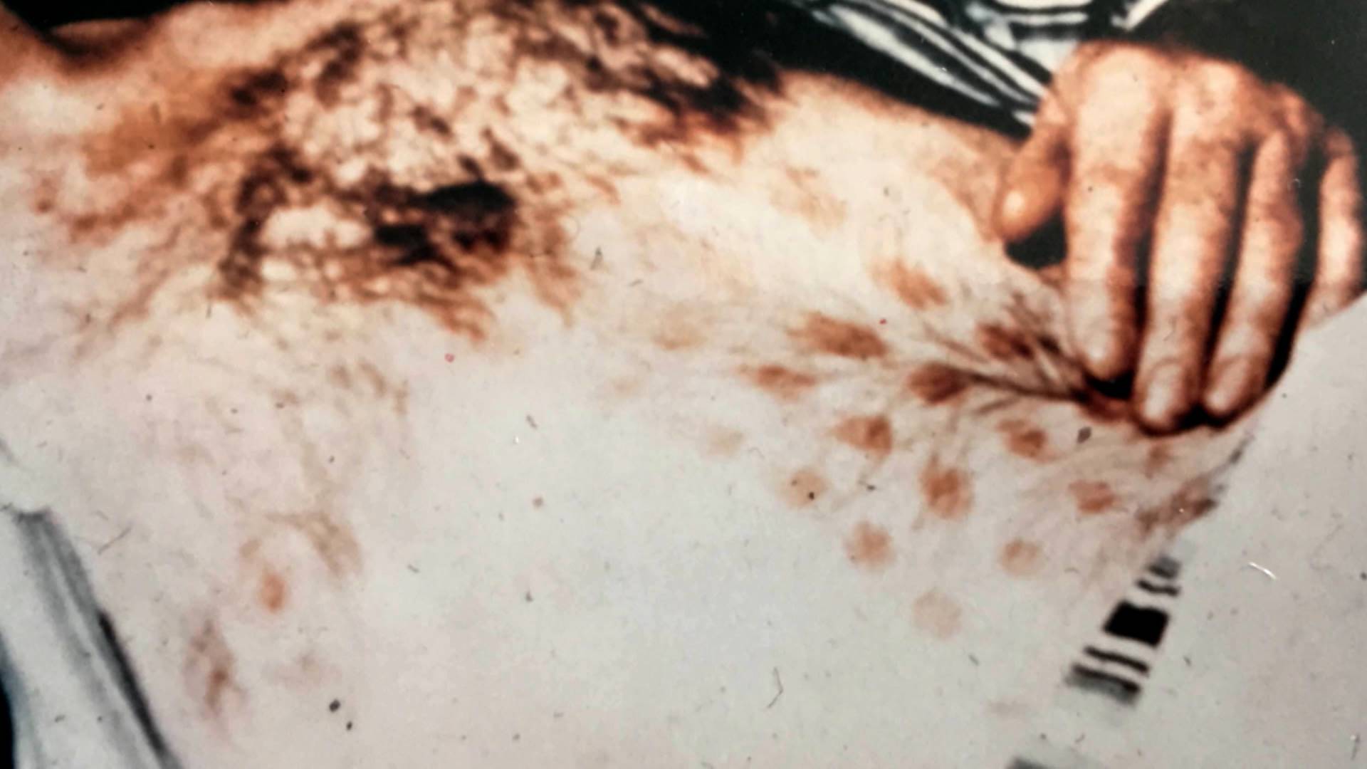 Apollo 16 UFO, Radiation Burn Mystery, Bosnian ...